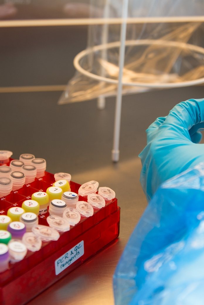 Image of a person with a pipette.