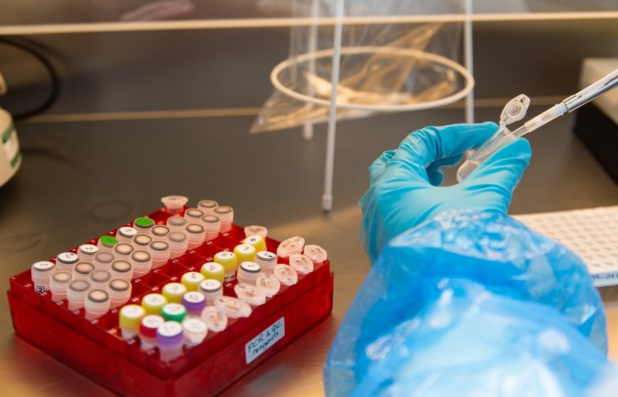 Image of a person with a pipette.