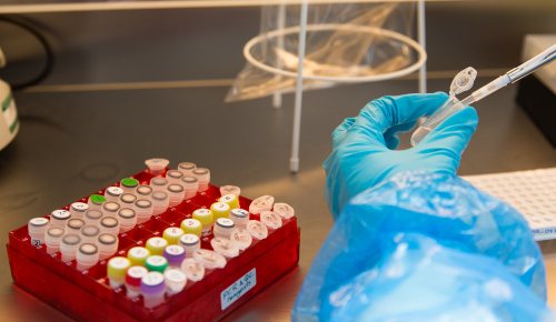 Image of a person with a pipette.